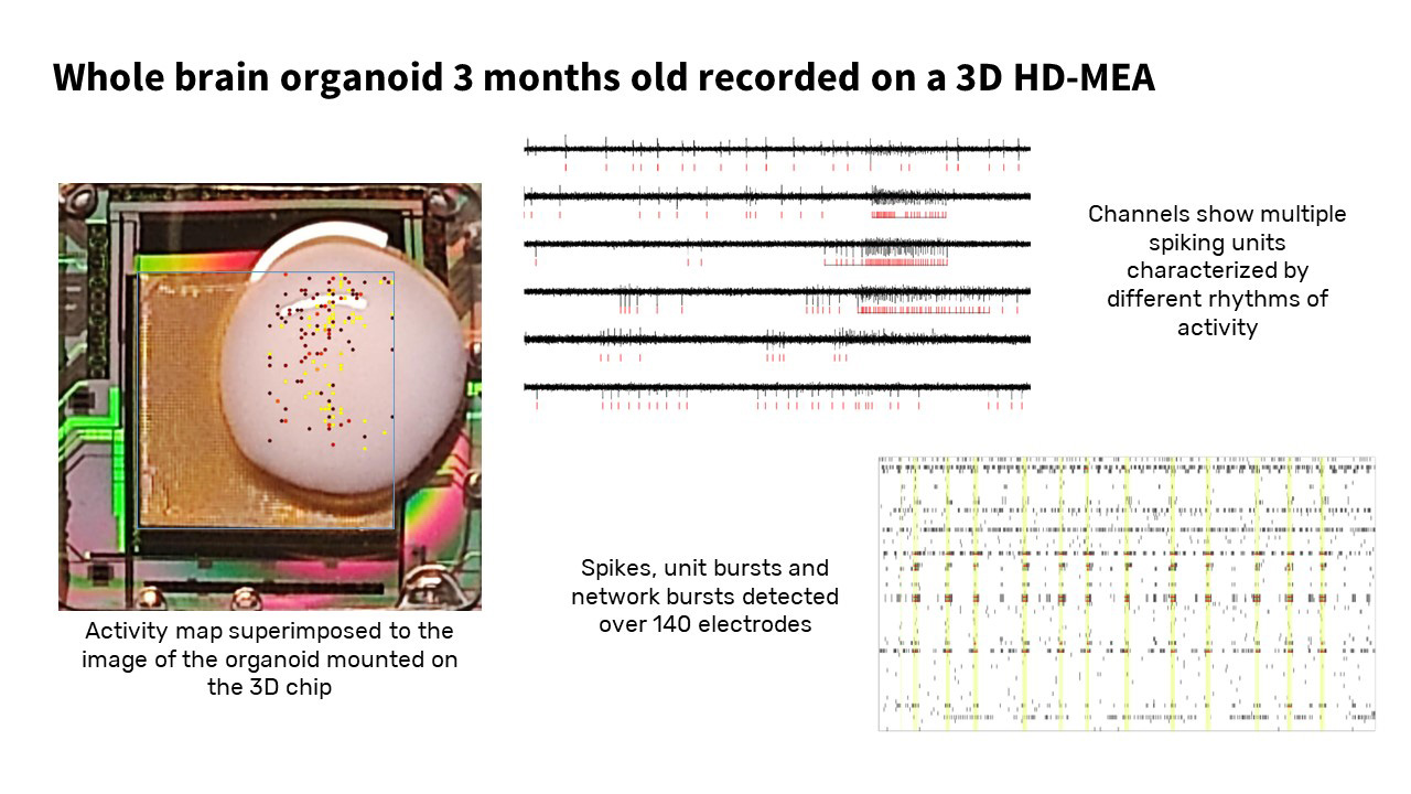 Invisible in 2 Dimensions: different regions of the brain organoid might be characterized by different rhythms. (unpublished) (Image: Courtesy of a:head bio AG)