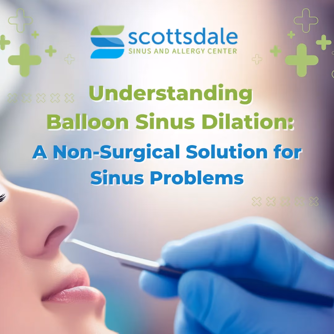 Understanding Balloon Sinus Dilation: A Non-Surgical Solution for Sinus Problems