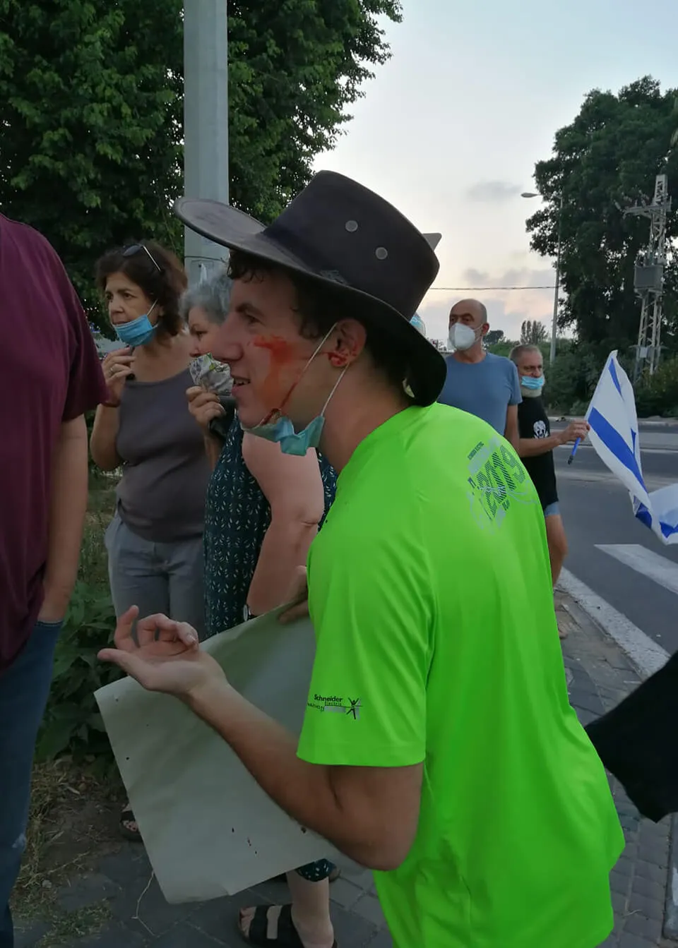 "היה לו רצח בעיניים". קדוש לאחר שנפגע בפניו בהפגנה (צילום: נדין וול)