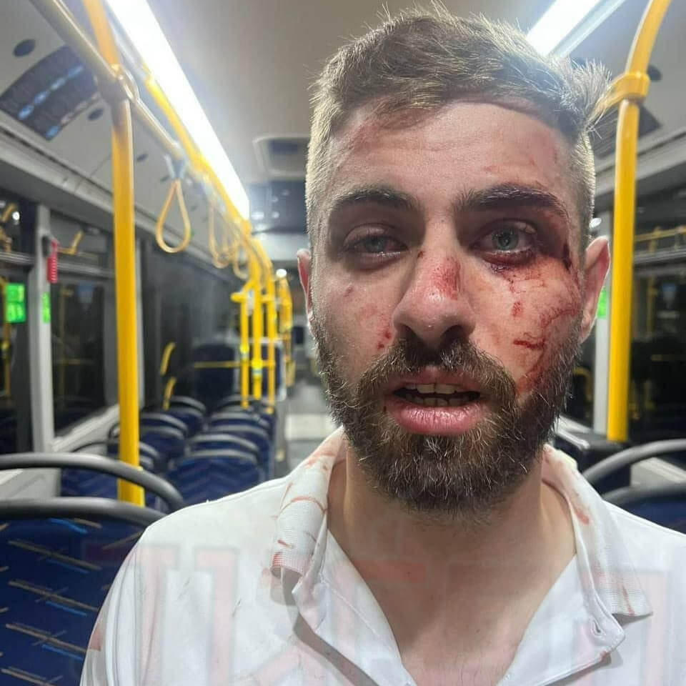 נהג האוטובוס אחמד אלמוגרבי תושב ירושלים, שהותקף בשכונת נווה יעקב בעיר ביולי 2025. צילום באדיבות הפרגוד