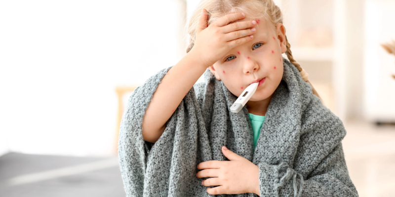 Young child with a fever and spots due to chickenpox.