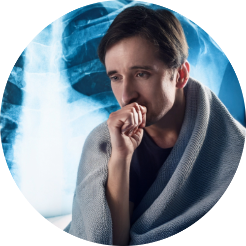 Chest X-ray showing fluid in lungs, next to a coughing patient with a blanket.