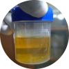 Gloved hand holding a urine sample cup for laboratory testing.