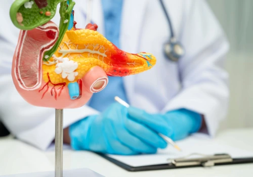 Laparoscopic Gallbladder Surgery (Cholecystectomy): When It’s Needed & What to Expect