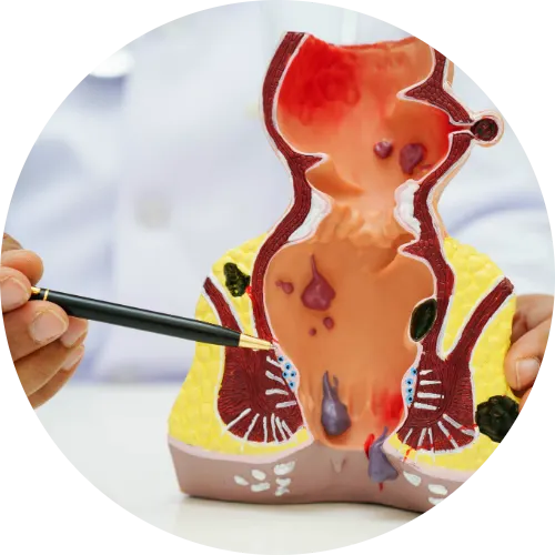Colon And Rectal Surgery
