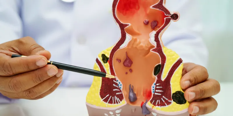 Colon And Rectal Surgery