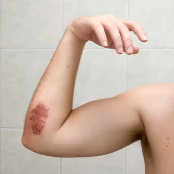 How to Tell If a Wound Is Healing Correctly: Signs of Recovery and Infection