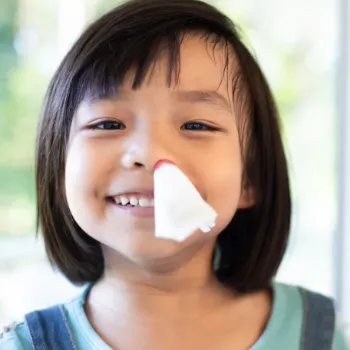 A smiling child gently plugging their nose with a tissue to stop a mild nosebleed.