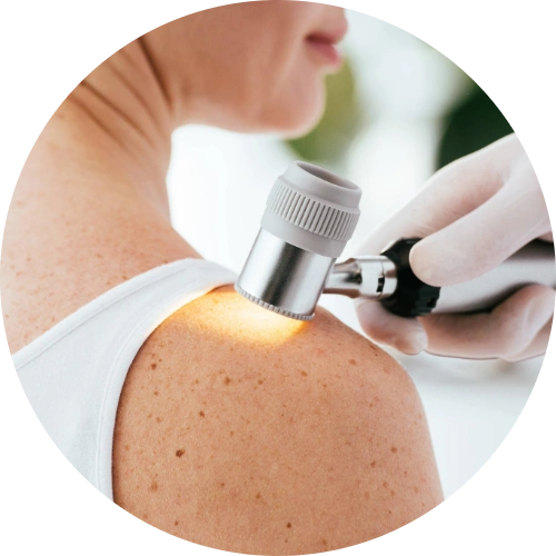 Cropped view of dermatologist holding dermascope while examining patient for skin cancer.