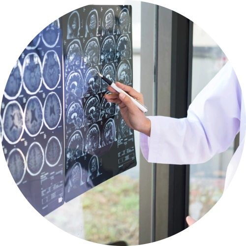 Neurological Surgery