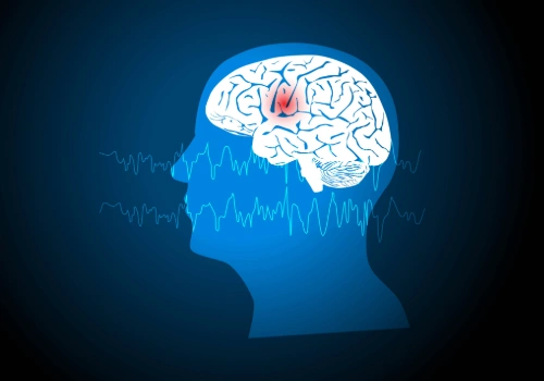 Design of a human head with a part of the brain highlighted red to signify seizure activity.