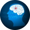 Design of a human head with a part of the brain highlighted red to signify seizure activity.