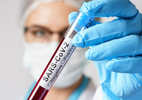 Female doctor is holding a blood sample of the SARS-CoV-2.