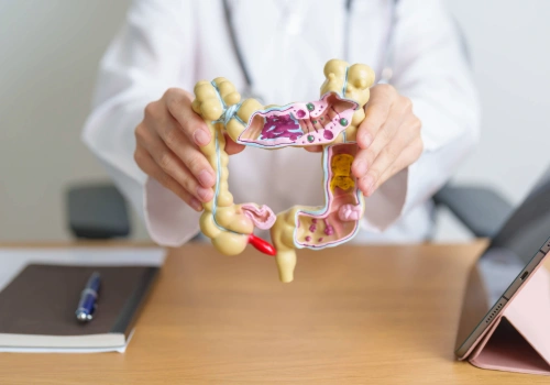 Doctor holding a 3D model of the colon while explaining colon cancer screening guidelines.