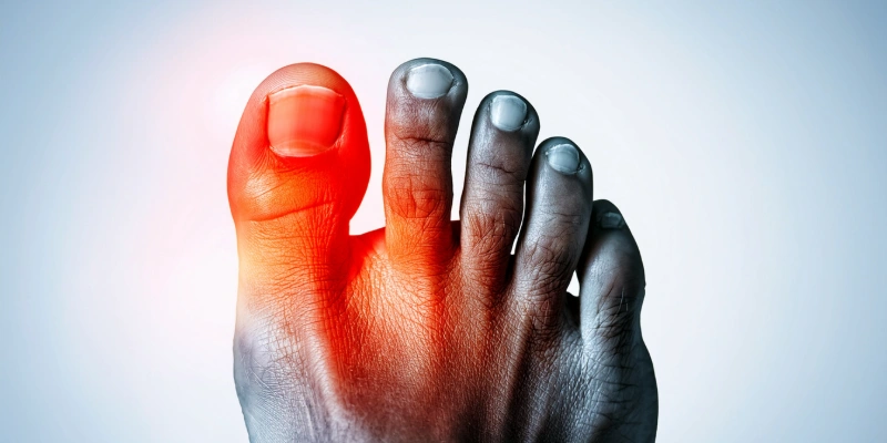 Bare foot with a visible bunion, highlighted red to signify pain.