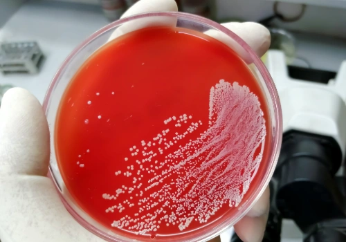 Petri dish showing Staphylococcus aureus (staph) bacterial growth