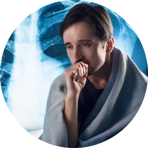 Chest X-ray showing fluid in lungs, next to a coughing patient with a blanket.