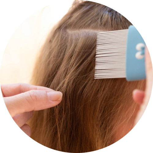Close-up of hair showing nits attached near the scalp consistent with head lice