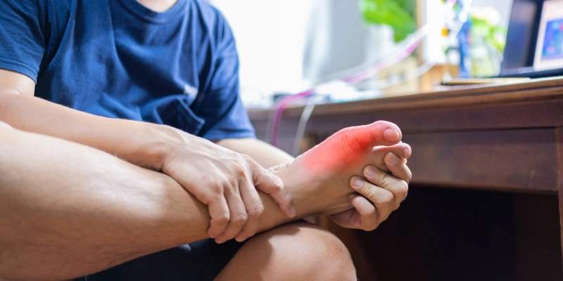Swollen and red big toe joint consistent with gout