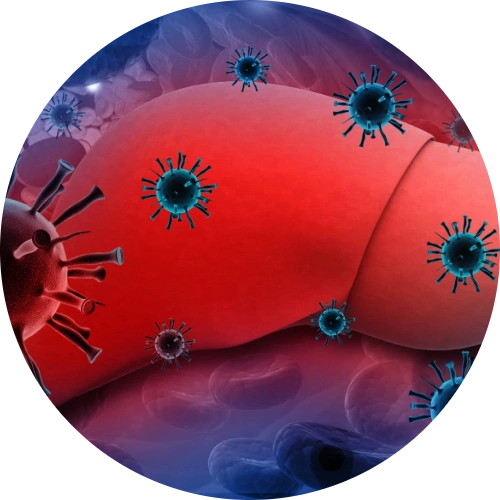 Liver Infection with hepatitis viruses