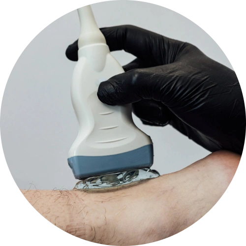 Doctor performing an ultrasound of a heel to look for achilles tendon rupture