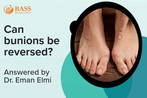 Video thumbnail showing feet with a bunion and text asking if bunions can be reversed