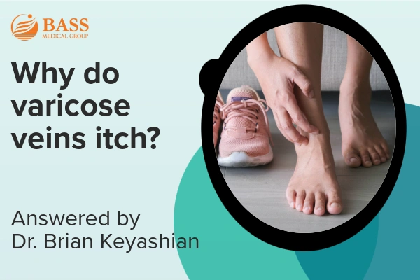Video thumbnail featuring woman itching her veiny foot