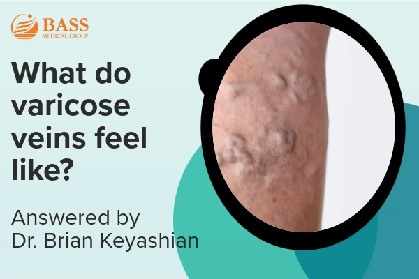 Video thumbnail featuring bulging veins on a lower leg