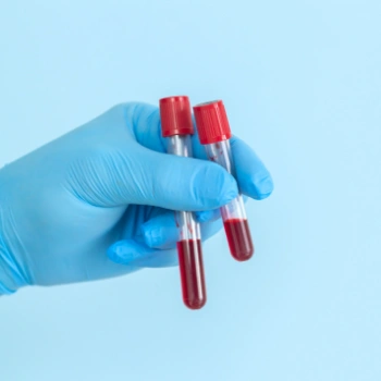 Gloved hand holding two vials of blood