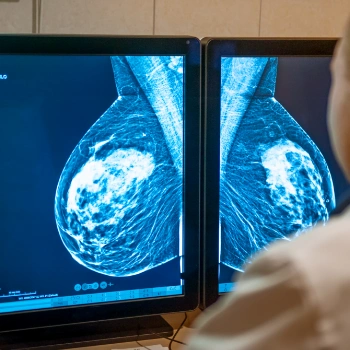 Radiologist examining mammogram imaging results