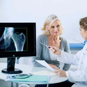 Doctor explaining DEXA scan results to an osteoporosis patient