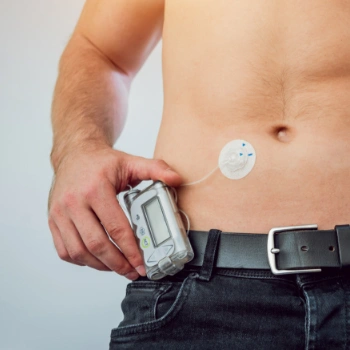 Man with automatic insulin pump attached to his chest