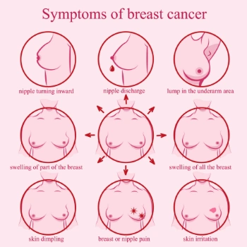 Chart showing the various symptoms of breast cancer