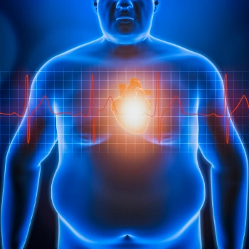 3D model of an obese man with an EKG line