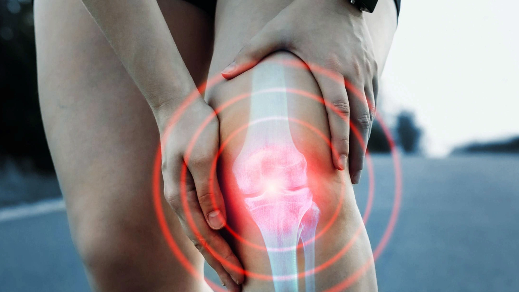 Woman suffering knee pain from osteoarthritis