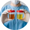 Medical professional holding two urine sample containers for UTI and STI testing