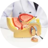 Doctor reviewing a 3D male urinary anatomy model while discussing enlarged prostate treatment options