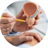 Urologist explaining prostate anatomy with a model during a patient consultation