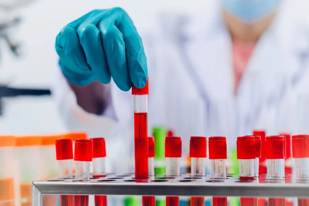 Alternative Lab Options for Top Vibrant America Labs