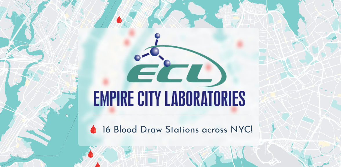 NY, NJ Empire City Laboratories Now On Rupa
