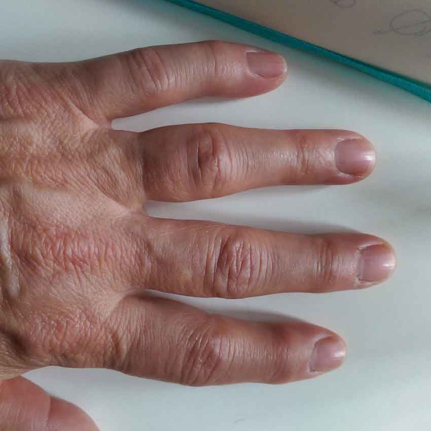 Knuckle too big for ring to go over and ring is slipping