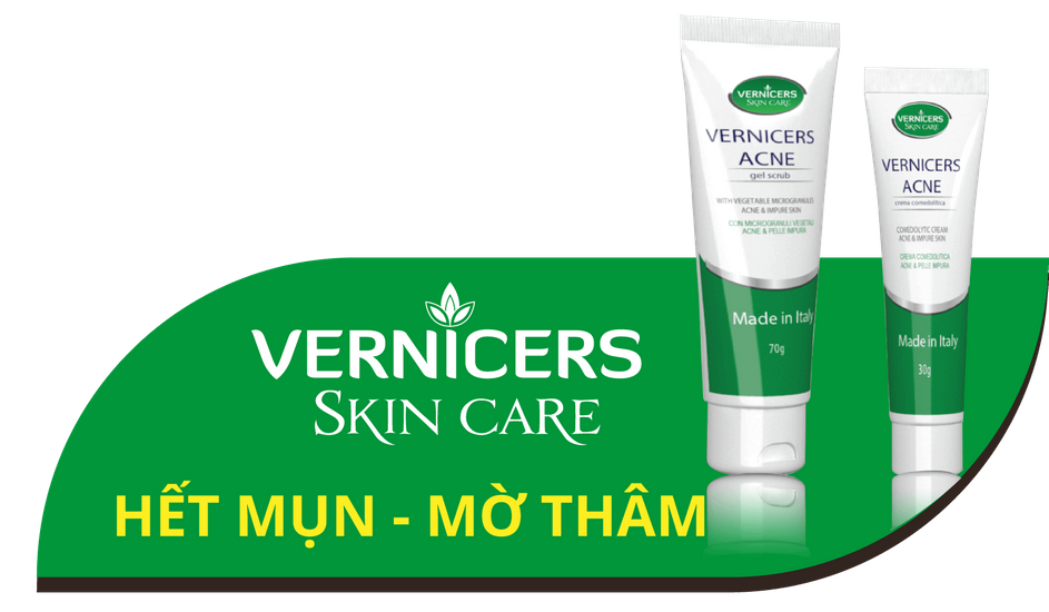 Kem trị mụn VERNICERS ACNE mua bán ở đâu? Giá bao nhiêu? Có tốt không?