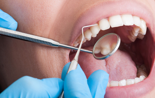 dental hygienist tauranga