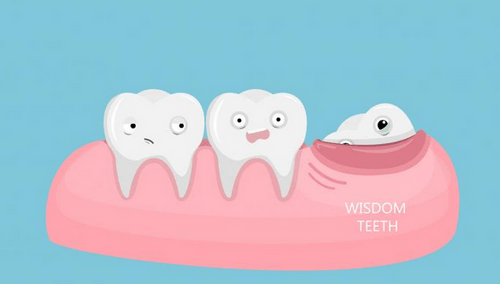 wisdom tooth tauranga