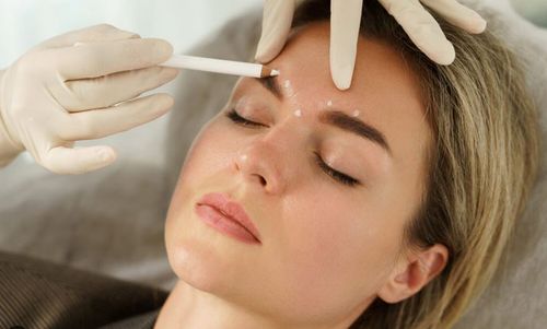 cosmetic injectables tauranga