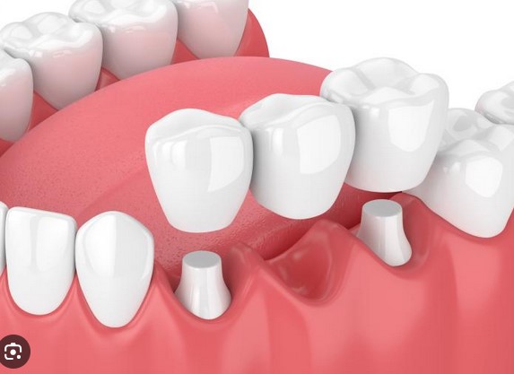 duncan dental tauranga