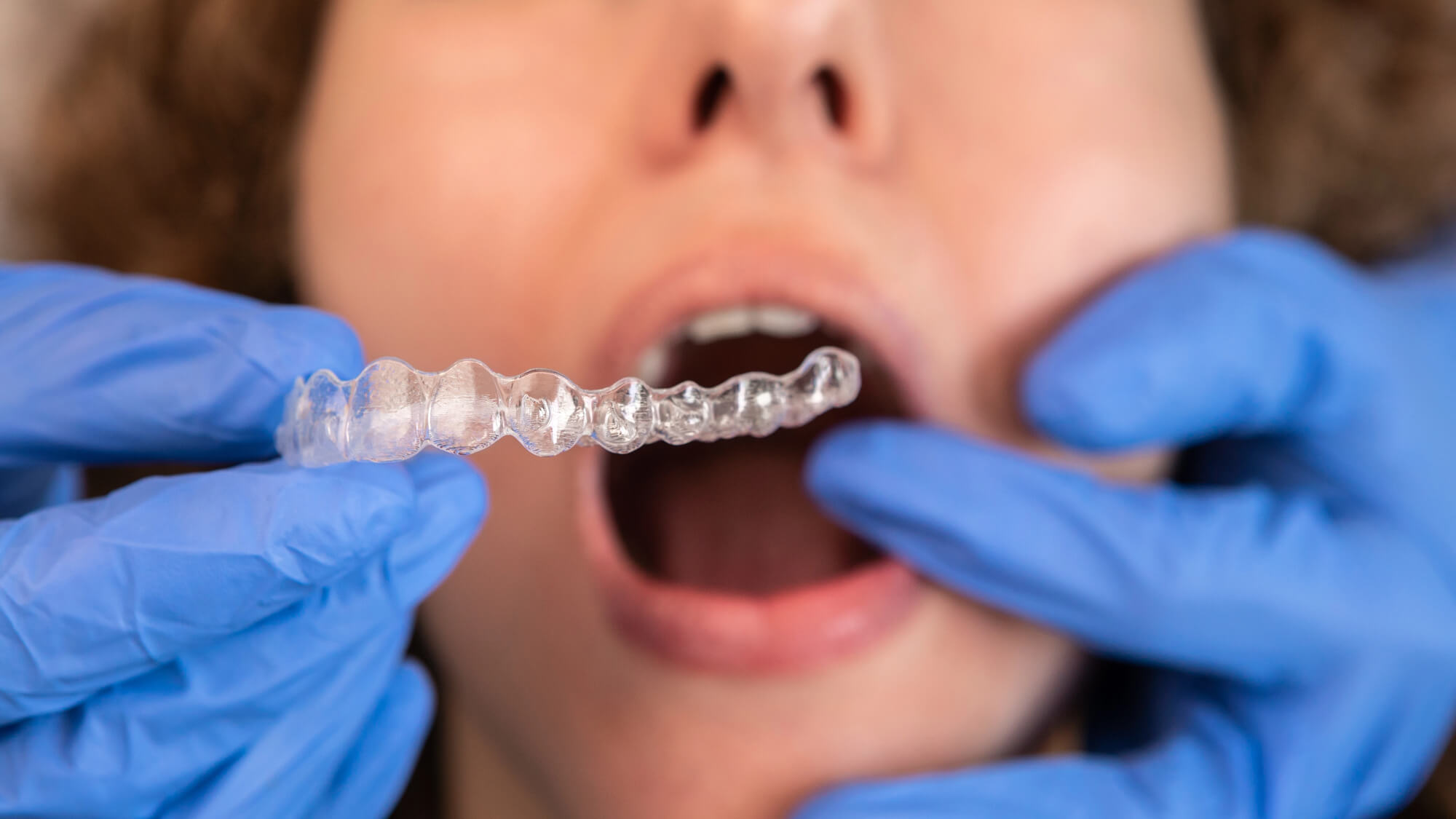 woman getting affordable Invisalign treatment