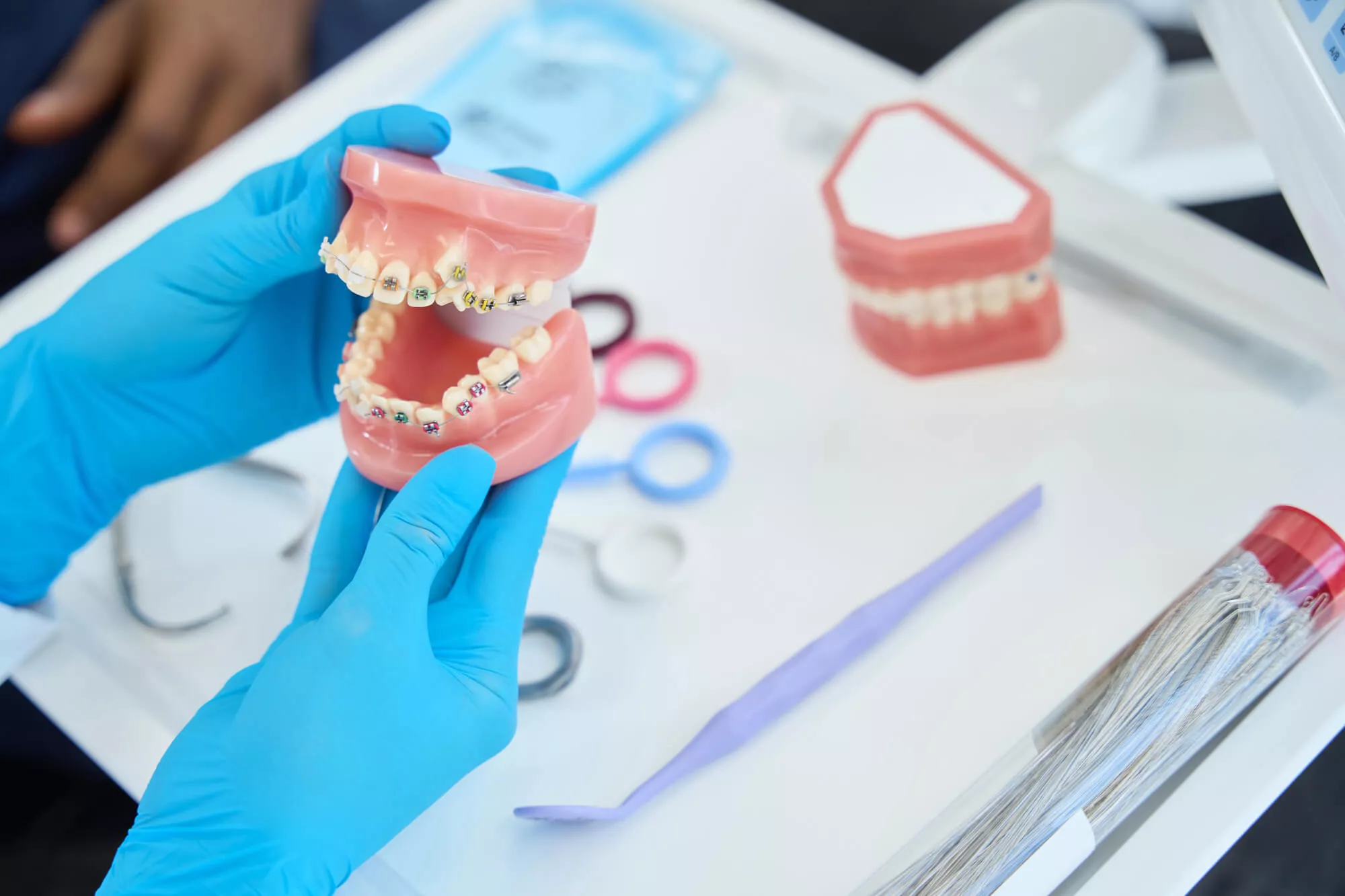 dentist in broward county with braces model