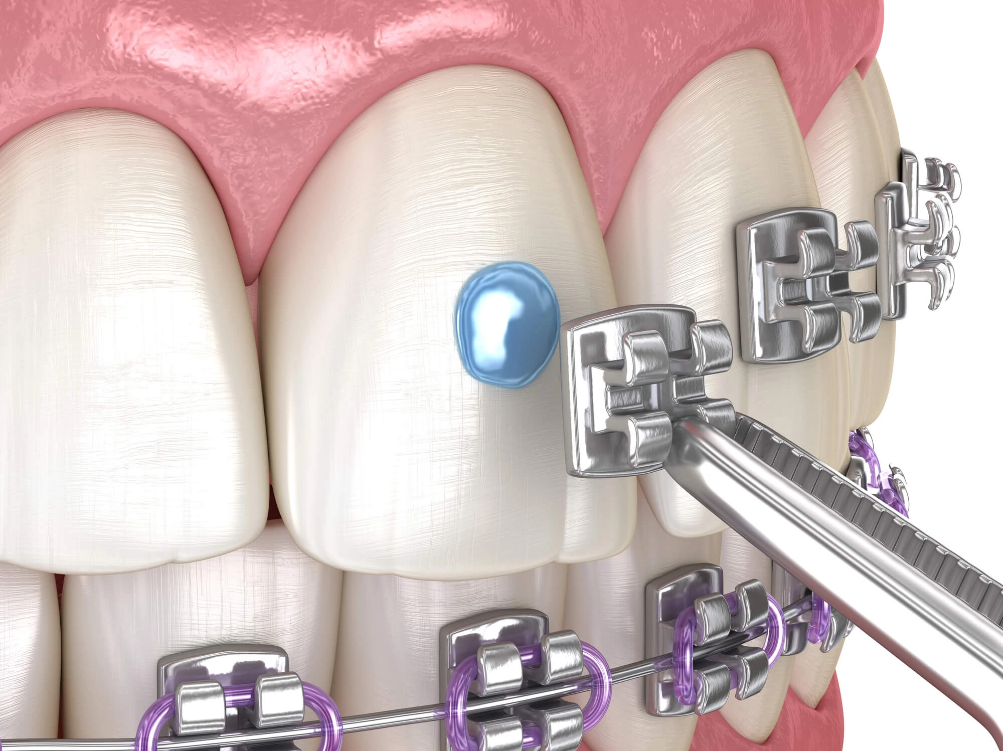 orthodontic treatment services
