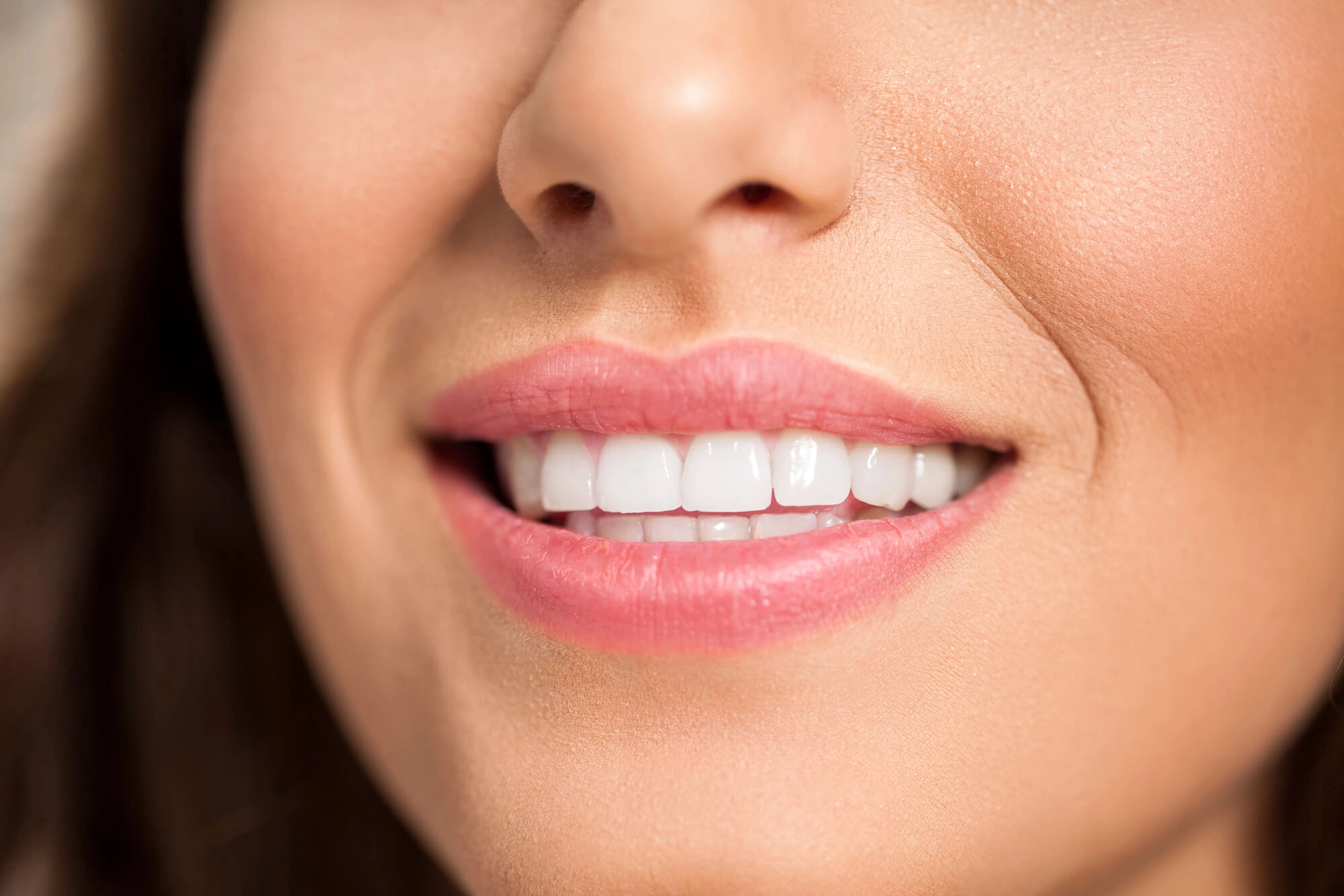 Smiling with affordable dental veneers